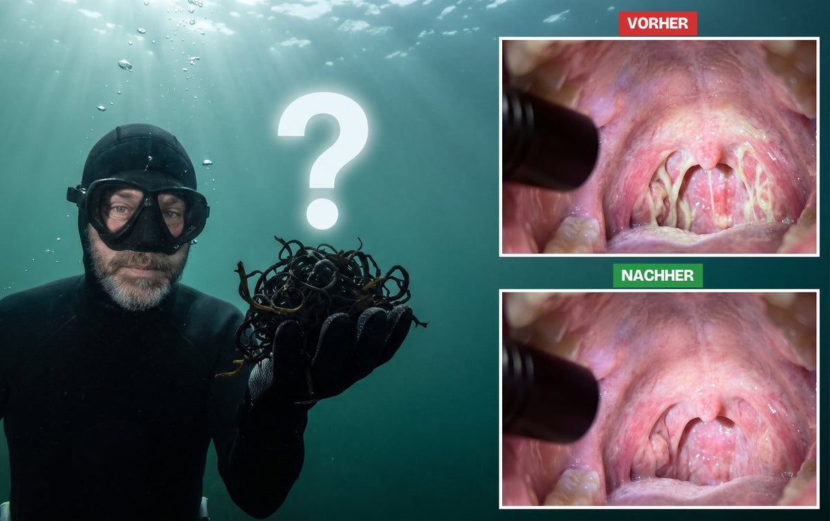 Ein irischer Taucher unter Wasser im schwarzen Neoprenanzug hält dunkles Moos in der offenen Hand, darüber ein großes Fragezeichen. Rechts derselbe Hals VORHER (rot, voller Schleim) und NACHHER (sauber und ruhig)