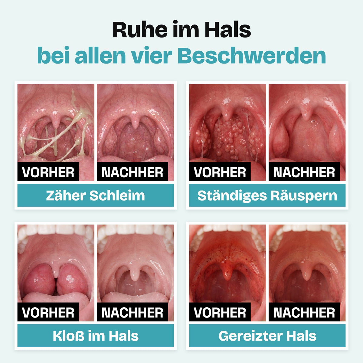 Ruhe im Hals bei allen vier Beschwerden: vorher und nachher